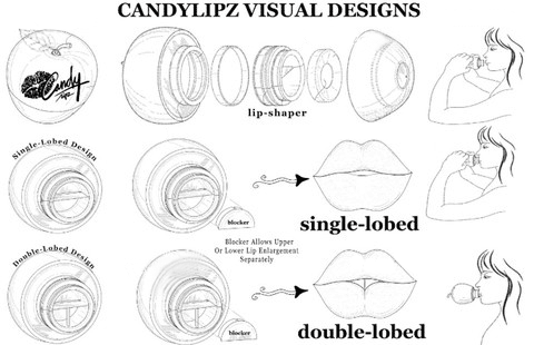 SET 1: Genuine CandyLipz Apple Lip Plumper Set (S to M) | 100k Orders Milestone Reached! - original and authentic lip-plumping device - CandyLipz Official Store
